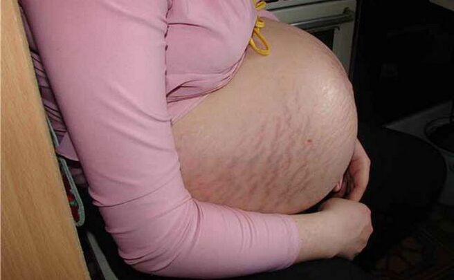 haurdunaldian barizearen arrazoiak