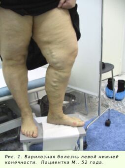 Barizeak tratatu behar dira prozesua geldiarazteko