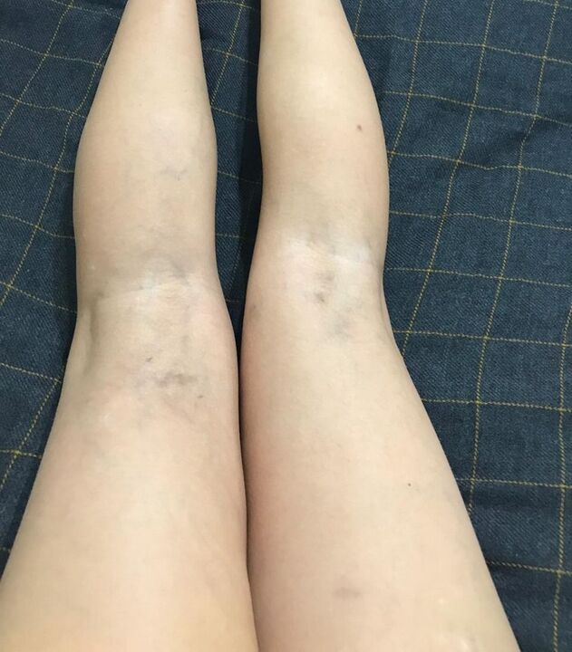 agerpenak barizeak hanketan